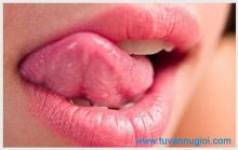 Bệnh giang mai ở lưỡi và cách điều trị hiệu quả ?
