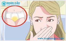 Nguyên nhân và Cách xử lý sản dịch có mùi hôi