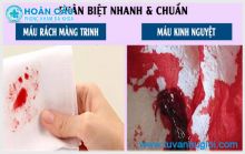 [TP.HCM] Phân biệt máu kinh nguyệt và máu rách màng trinh khác nhau ra sao