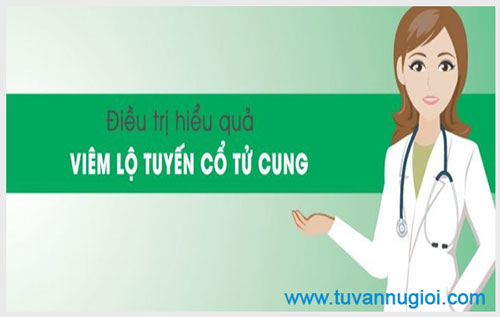 Cách điều trị viêm lộ tuyến cổ tử cung cấp độ 1, 2, 3 nhanh khỏi 