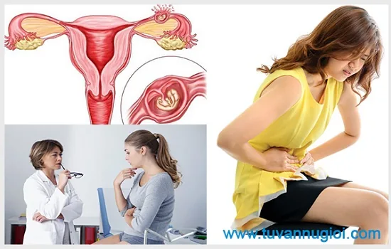 Hãy đến cơ sở uy tín để điều trị viêm phần phụ nhé!
