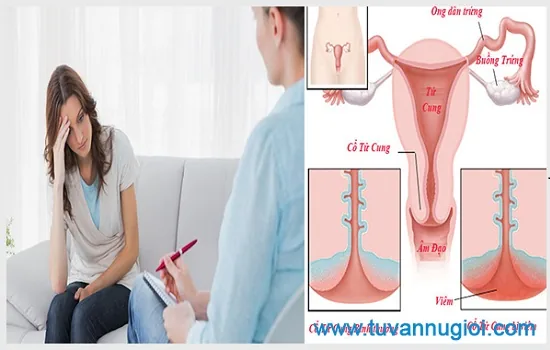 Có nhiều nguyên nhân gây bệnh viêm phần phụ ở phụ nữ