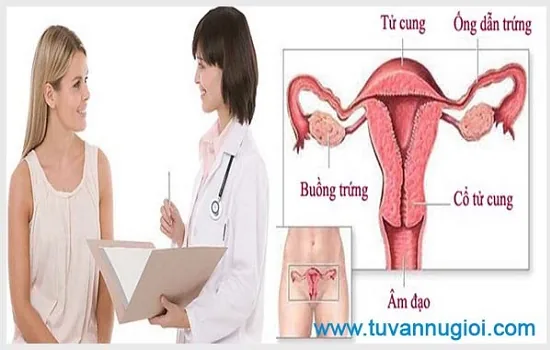 Cần sớm điều trị viêm phần phụ ở phụ nữ