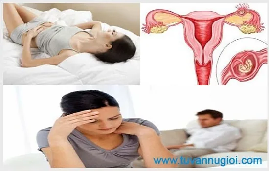 Có nhiều nguyên nhân gây viêm phần phụ ở phụ nữ