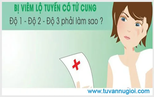 Đốt điện viêm lộ tuyến cổ tử cung ở đâu tốt ?