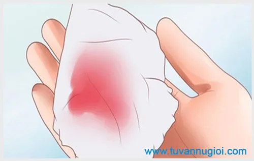 Hiện tượng ra chất dịch nhầy màu hồng là bệnh gì?