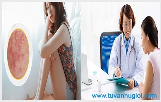 Cần sớm chữa nổi hột tại vùng kín nữ