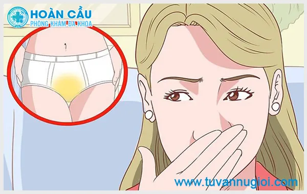 [TP.HCM] Đáy quần lót có màu vàng là do đâu và cần làm gì? – ảnh 1