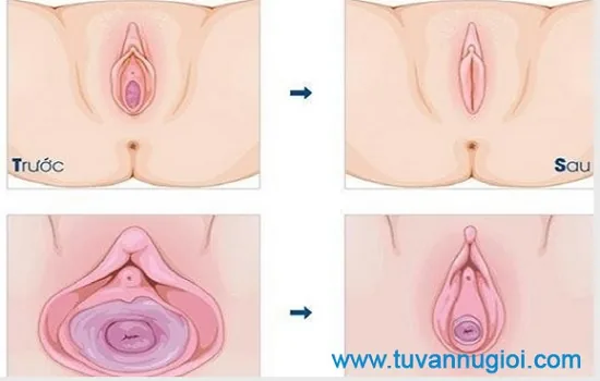 Cần thăm khám chuyên gia phụ khoa theo định kỳ