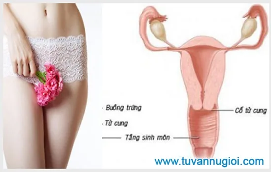 Viêm phần phụ có thể xảy ra ở nhiều đối tượng khác nhau