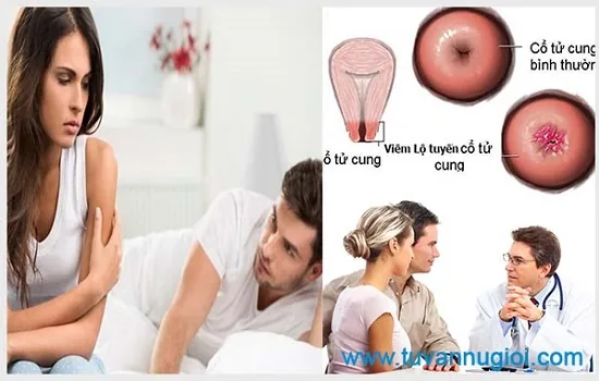 Cần điều trị viêm lộ tuyến tại cơ sở uy tín