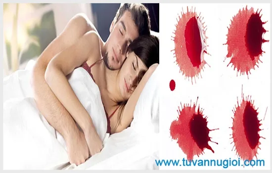 Tình trạng quan hệ bị ra máu nhưng không đau là biểu hiện nhiều bệnh khác nhau!
