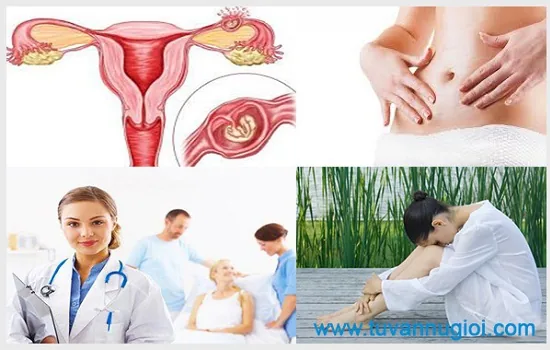 Hãy điều trị viêm phần phụ tại cơ sở uy tín chất lượng