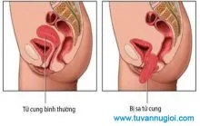 Ảnh minh họa bài: Cùng Phòng khám Đa khoa Hoàn Cầu tìm hiểu bấm huyệt chữa sa tử cung có hiệu quả