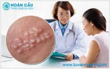 Ảnh minh họa bài: Hạt bã nhờn vùng kín và cách điều trị an toàn hiệu quả
