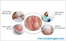 Ảnh minh họa bài: Viêm tuyến bartholin bị vỡ có nguy hiểm không, điều trị như thế nào?
